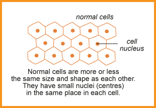 Normal cells are more or less the same shape as each other. They have small nuclei (centres) in the same place in each cell.
